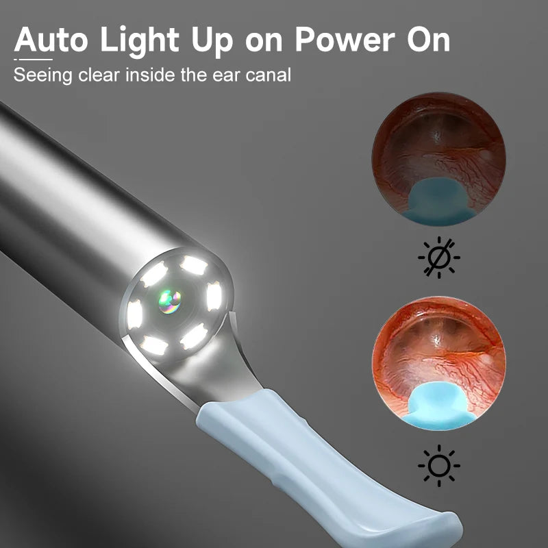 Smart Visual Ear Wax Cleaner HD1080P 4.2MM